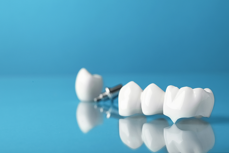 Restore Your Smile with Dental Crowns and Bridges in Stratford, CT